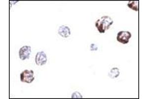 Immunocytochemistry of IRGC in A20 cells with this product at 2. (IRGC 抗体  (C-Term))