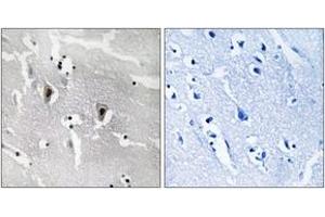 Immunohistochemistry analysis of paraffin-embedded human brain tissue, using RBM6 Antibody. (RBM6 抗体  (AA 991-1040))