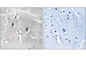 Immunohistochemistry analysis of paraffin-embedded human brain tissue, using RBM6 Antibody. (RBM6 抗体  (AA 991-1040))
