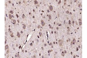 Immunohistochemistry (Paraffin-embedded Sections) (IHC (p)) image for anti-Neurotrophic Tyrosine Kinase, Receptor, Type 1 (NTRK1) (AA 101-200) antibody (ABIN1715057)