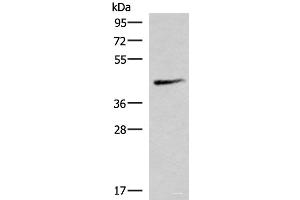 Western blot analysis of Mouse lung tissue lysate using SMPD2 Polyclonal Antibody at dilution of 1:1000 (SMPD2 抗体)