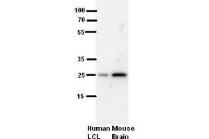 WB Suggested Anti-SH3BGR Antibody Blocking:  5% Milk  Antibody dilution:  1:500  Positive Control:  human LCL and mouse brains (SH3BGR 抗体  (N-Term))