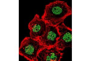 Fluorescent confocal image of A431 cell stained with HOMEZ Antibody (N-term) (ABIN654727 and ABIN2844415). (HOMEZ 抗体  (N-Term))