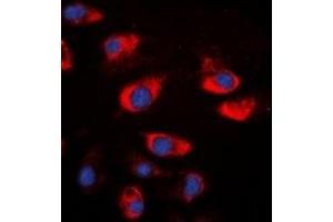 Immunofluorescent analysis of Cystatin A staining in A549 cells. (CSTA 抗体)
