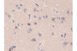 Detection of SMC3 in Human Cerebrum Tissue using Polyclonal Antibody to Structural Maintenance Of Chromosomes Protein 3 (SMC3)