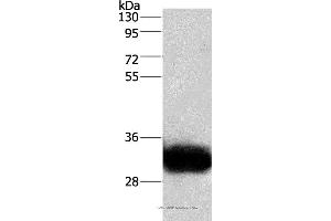 Western blot analysis of Human fetal brain tissue, using GPM6A Polyclonal Antibody at dilution of 1:950 (GPM6A 抗体)
