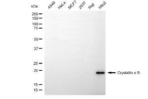 Western blotting analysis using crystallin alpha B antibody (ABIN7798169). (Recombinant CRYAB 抗体)