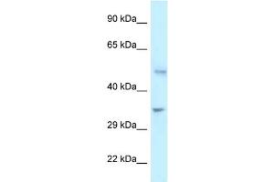 WB Suggested Anti-PFKFB1 Antibody Titration: 1. (PFKFB1 抗体  (C-Term))