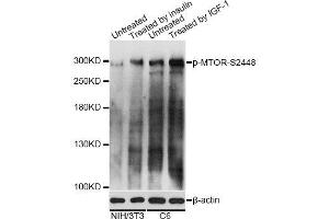 Western blot analysis of extracts of NIH/3T3 and C6 cells, using Phospho-MTOR-S2448 antibody. (MTOR 抗体  (pSer2448))