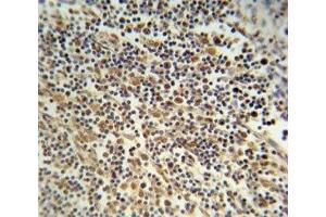 NLRP3 antibody immunohistochemistry analysis in formalin fixed and paraffin embedded human lymph tissue. (NLRP3 抗体  (AA 65-91))