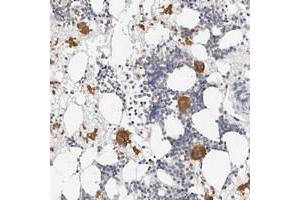 Immunohistochemical staining of human bone marrow with ZRANB1 polyclonal antibody  shows distinct cytoplasmic positivity in bone marrow poietic cells at 1:50-1:200 dilution. (ZRANB1 抗体)