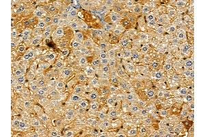 ACVL1 Mouse Monoclonal Antibody at 1/100 staining mouse liver tissue by IHC-P.