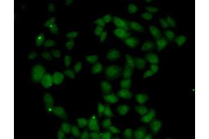 Immunofluorescence analysis of U20S cell using FGF14 antibody. (FGF14 抗体)