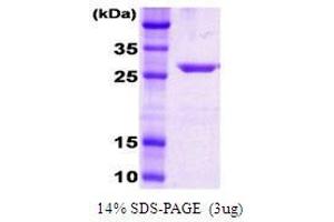 Figure annotation denotes ug of protein loaded and % gel used. (DnaK (AA 385-638), (C-Term) Peptide)