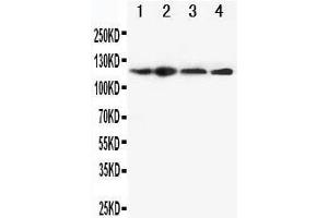 Anti-CIAS1/NALP3 antibody, Western blotting Lane 1: HEP-2 Cell Lysate Lane 2: A549 Cell Lysate Lane 3: U87 Cell Lysate Lane 4: CEM Cell Lysate (NLRP3 抗体  (N-Term))