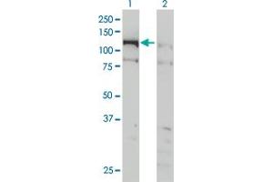 Western Blotting (WB) image for anti-CTF18, Chromosome Transmission Fidelity Factor 18 Homolog (CHTF18) (AA 886-975) antibody (ABIN566224)