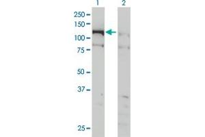 Western Blot analysis of CHTF18 expression in transfected 293T cell line by CHTF18 monoclonal antibody (M01), clone 1F5. (CTF18 抗体  (AA 886-975))