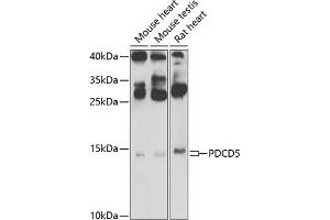 Western blot analysis of extracts of various cell lines, using PDCD5 Antibody (ABIN6132965, ABIN6145338, ABIN6145339 and ABIN6223132) at 1:500 dilution. (PDCD5 抗体  (AA 1-125))