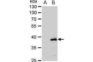 WB Image YKL-39 antibody [N1C3] detects YKL-39 protein by western blot analysis. (CHI3L2 抗体)