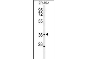 Western blot analysis of MIIP Antibody (C-term) (ABIN651250 and ABIN2840153) in ZR-75-1 cell line lysates (35 μg/lane). (MIIP 抗体  (C-Term))