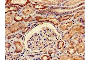 Immunohistochemistry of paraffin-embedded human kidney tissue using ABIN7173996 at dilution of 1:100 (YARS 抗体  (AA 2-528))