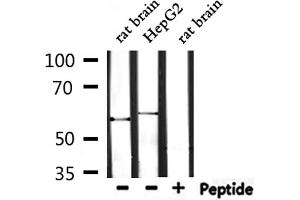 Western blot analysis of extracts from rat brain and HepG2, using TRIO Antibody. (TRIO 抗体  (Internal Region))
