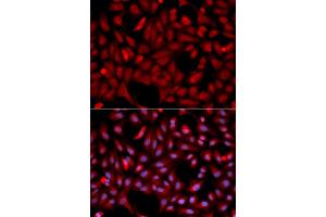 Immunofluorescence (IF) image for anti-E3 Ubiquitin-Protein Ligase SIAH1 (SIAH1) antibody (ABIN1874778) (SIAH1 抗体)