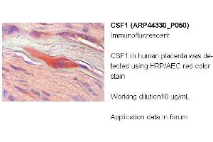 Image no. 2 for anti-Colony Stimulating Factor 1 (Macrophage) (CSF1) (Middle Region) antibody (ABIN502500) (M-CSF/CSF1 抗体  (Middle Region))