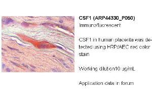 Image no. 2 for anti-Colony Stimulating Factor 1 (Macrophage) (CSF1) (Middle Region) antibody (ABIN2781823)