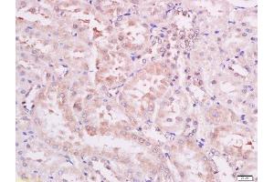 Immunohistochemistry (Paraffin-embedded Sections) (IHC (p)) image for anti-3-phosphoinositide Dependent Protein Kinase-1 (PDPK1) (pSer241) antibody (ABIN744668)