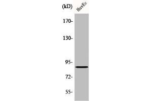 Western Blot analysis of HuvEc cells using cGKII Polyclonal Antibody (PRKG2 抗体  (Internal Region))
