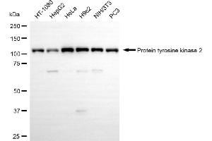Western blotting analysis using protein tyrosine kinase 2 antibody (ABIN7800062). (Recombinant FAK 抗体)
