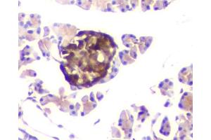 IHC analysis of ATP citrate lyase using anti-ATP citrate lyase antibody (ABIN6719406). (ACLY 抗体  (AA 1-180))