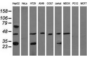 Western blot analysis of extracts (35 µg) from 9 different cell lines by using anti-QPRT monoclonal antibody. (QPRT 抗体)
