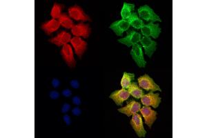 ABIN6258102 and ABIN6273682 staining Hela cells by IF/ICC.