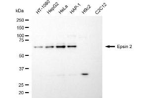 Western blotting analysis using epsin 2 antibody (ABIN7798489). (Epsin 2 抗体)
