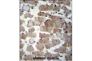 CTSK Antibody (Center ) (ABIN656812 and ABIN2846026) immunohistochemistry analysis in formalin fixed and paraffin embedded human skeletal muscle followed by peroxidase conjugation of the secondary antibody and DAB staining. (Cathepsin K 抗体  (AA 97-126))