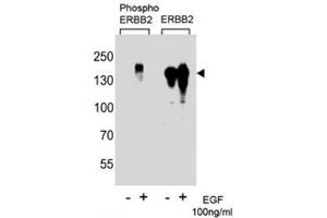 Western blot analysis of extracts from A431 cells, untreated or treated with EGF (100ng/ml) using phospho-ErbB2 antibody (left) or nonphos Ab (right)