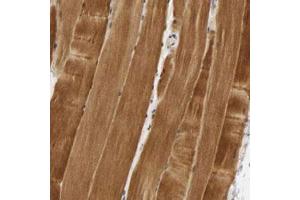 Immunohistochemical staining (Formalin-fixed paraffin-embedded sections) of human skeletal muscle with PDLIM3 polyclonal antibody  shows strong cytoplasmic positivity in myocytes. (PDLIM3 抗体)