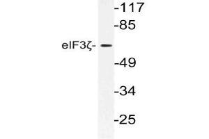 Western blot analysis using eIF3D antibody in extracts from 3T3 cells. (EIF3D 抗体)