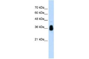 WB Suggested Anti-MKRN1 Antibody Titration:  1. (MKRN1 抗体  (C-Term))
