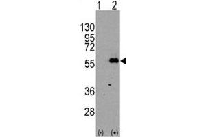 Western blot analysis of MEF2C (arrow) using rabbit polyclonal MEF2C Antibody  (R). (MEF2C 抗体  (AA 374-403))