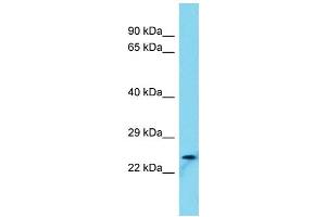 Host: Rabbit Target Name: FAM101B Sample Type: U937 Whole Cell lysates Antibody Dilution: 1. (FAM101B 抗体  (N-Term))