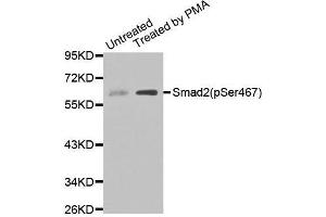 Western blot analysis of extracts of Untreated and treated 293T cell lines, using Phospho-SMAD2-S467 antibody. (SMAD2 抗体  (pSer467))