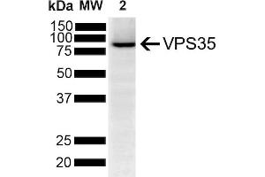 Western Blot analysis of Human SH-SY5Y showing detection of VPS35 protein using Mouse Anti-VPS35 Monoclonal Antibody, Clone 5A9 (ABIN6932942). (VPS35 抗体  (APC))