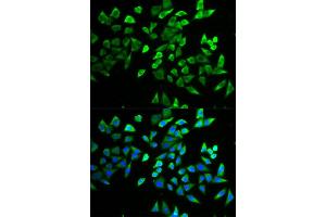 Immunofluorescence (IF) image for anti-Transcription Factor 19 (TCF19) antibody (ABIN1877133) (TCF19 抗体)