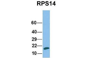 Western Blotting (WB) image for anti-Ribosomal Protein S14 (RPS14) (Middle Region) antibody (ABIN2778744)