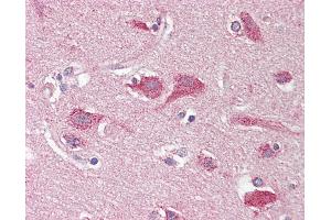 Anti-OPCML / OBCAM antibody IHC staining of human brain, cortex.