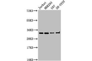 Western Blot Positive WB detected in: Jurkat whole cell lysate, HEK293 whole cell lysate, U87 whole cell lysate, SH-SY5Y whole cell lysate All lanes: CAMLG antibody at 3 μg/mL Secondary Goat polyclonal to rabbit IgG at 1/50000 dilution Predicted band size: 33 kDa Observed band size: 33 kDa (CAMLG 抗体  (AA 1-189))
