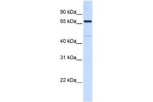 WB Suggested Anti-ACSL5 Antibody Titration:  0. (ACSL5 抗体  (C-Term))
